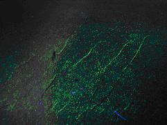 沖壓模具爆裂致人死亡 自磁化熒光磁粉探傷法查隱患